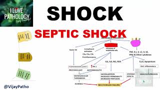 SHOCK Types Pathogenesis of Septic Shock [upl. by Gerrie]