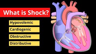 Shock Explained in 120 Seconds  Treatment Symptoms Causes  Video [upl. by Sundstrom]