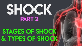 Stages of Shock  Types of Shock  Shock Part 2 [upl. by Worra182]