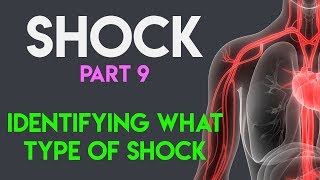 Identifying What Type Shock  Shock Part 9 [upl. by Bennink]