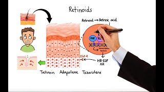 Pharmacology  ACNE TREATMENTS MADE EASY [upl. by Geoffry]